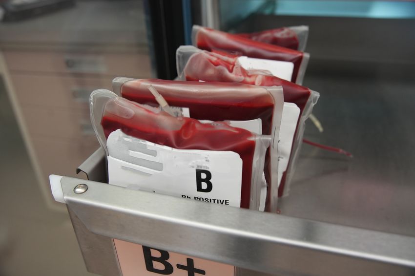 Earlier blood transfusion may reduce heart failure, arrhythmia in adults with heart disease – www.heart.org